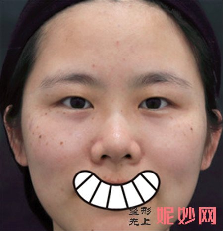 重庆华美祛斑医生宋文怎样？