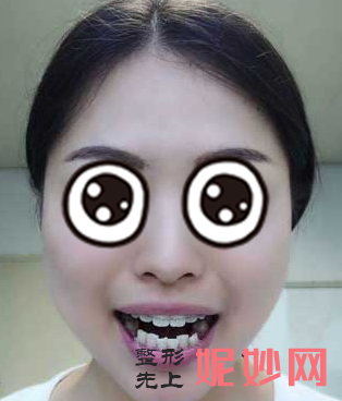 重庆吴承琼牙齿矫正怎么样？