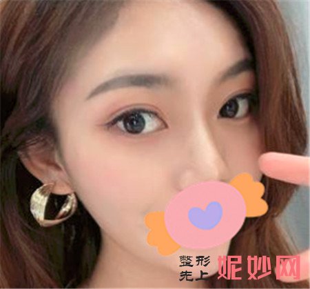 重庆华美杨加富做眼睛怎样？