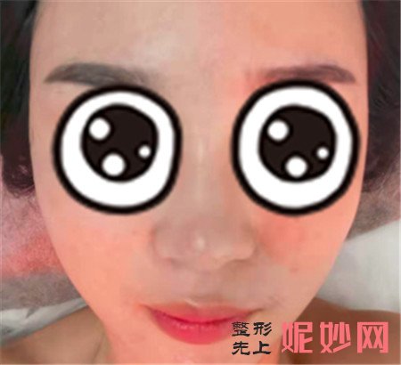 华美李任做鼻子怎么样？