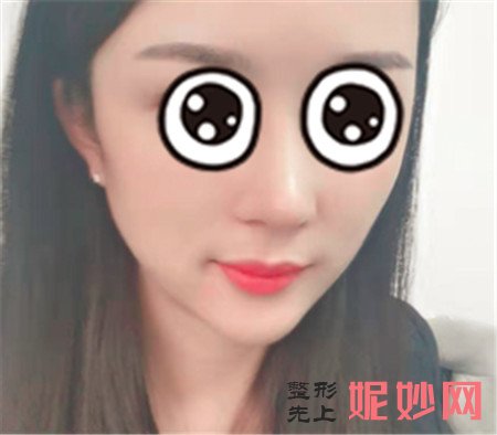 华美李任做鼻子怎么样？