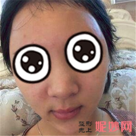 重庆华美杨健做鼻子怎么样？