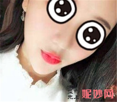 重庆华美杨健做鼻子怎么样？