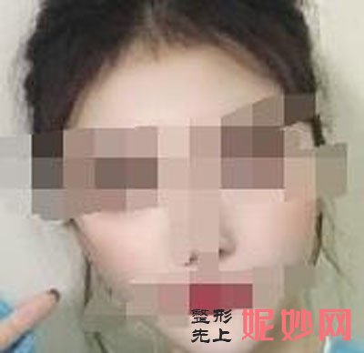 南京连天美美容医院可以祛疤痕吗？