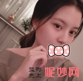金东勋做双眼皮怎么样？