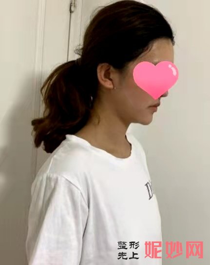 郑州熙禾整形医院怎么样?医生信息一览+丰胸效果分享！