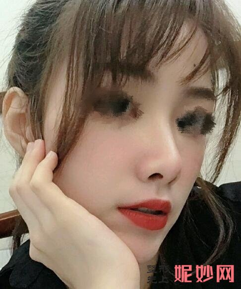 广州韩秀医疗美容医院怎么样？医生介绍+鼻综合分享