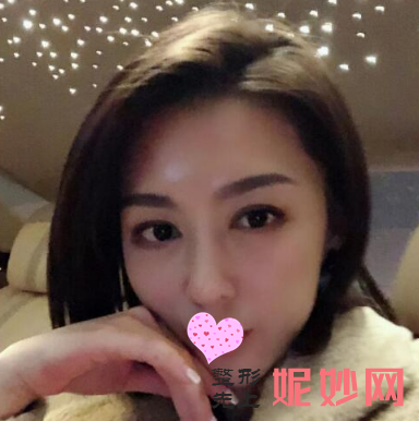 成都美立方医疗美容整形医院李建军除皱效果怎么样？皮肤平滑白嫩！