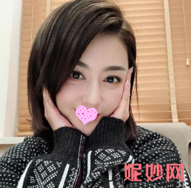 成都美立方医疗美容整形医院李建军除皱效果怎么样？皮肤平滑白嫩！