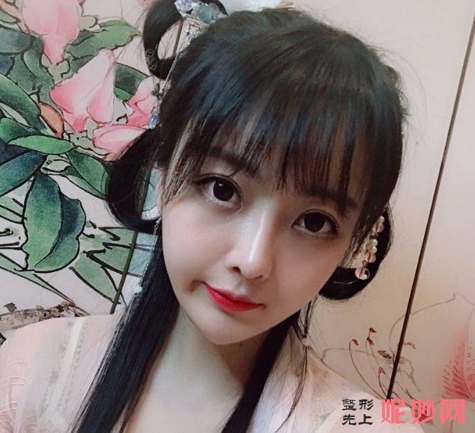 成都美立方医疗美容整形医院宋华敬面部脂肪填充术怎么样？超级减龄！