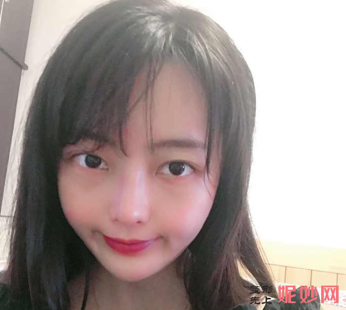成都美立方医疗美容整形医院宋华敬面部脂肪填充术怎么样？超级减龄！
