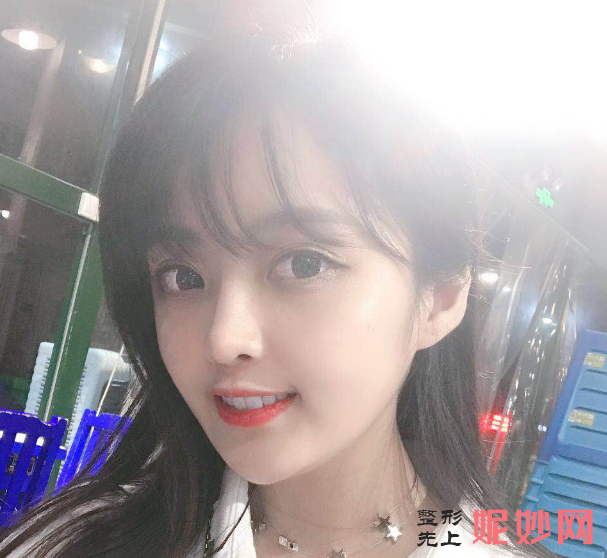 成都美立方医疗美容整形医院宋华敬面部脂肪填充术怎么样？超级减龄！