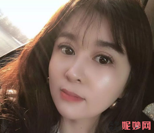 成都美立方医疗美容整形医院侯文婕面部年轻化怎么样？术后自信满满！