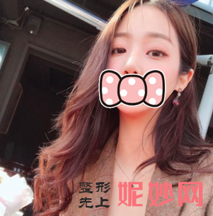易东风做脂肪填充怎么样？
