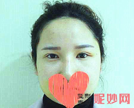 赵贵庆磨骨怎么样？