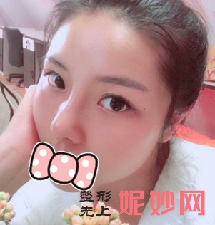 赵贵庆医生做的鼻子怎么样？