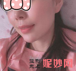 柳超医生磨骨怎么样？