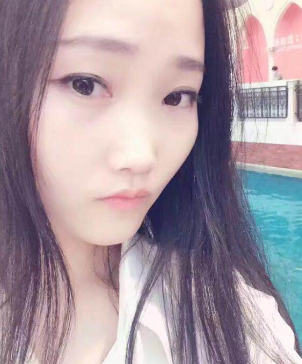 北京306医院整形科怎么样？医生汇总和隆鼻案例