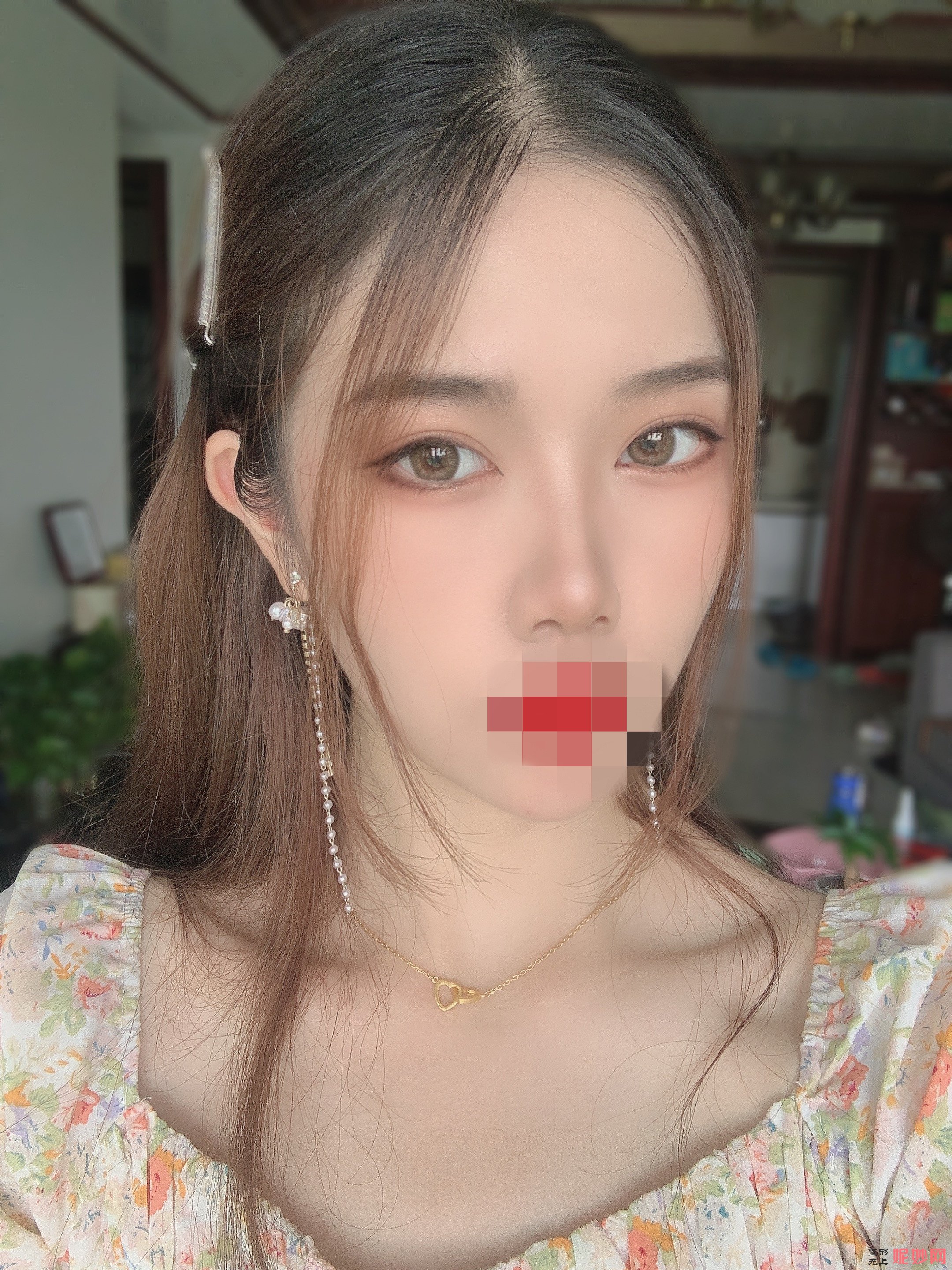 成都市西区医院整形美容科颜子云做双眼皮怎么样？让我眼睛从此好看起来了！