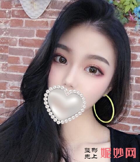 成都市西区医院整形美容科车红昌做双眼皮怎么样？让我从此自信起来了！