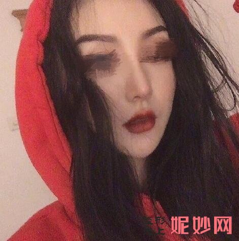 成都市西区医院整形美容科车红昌隆鼻怎么样？让我的鼻子非常自然了！