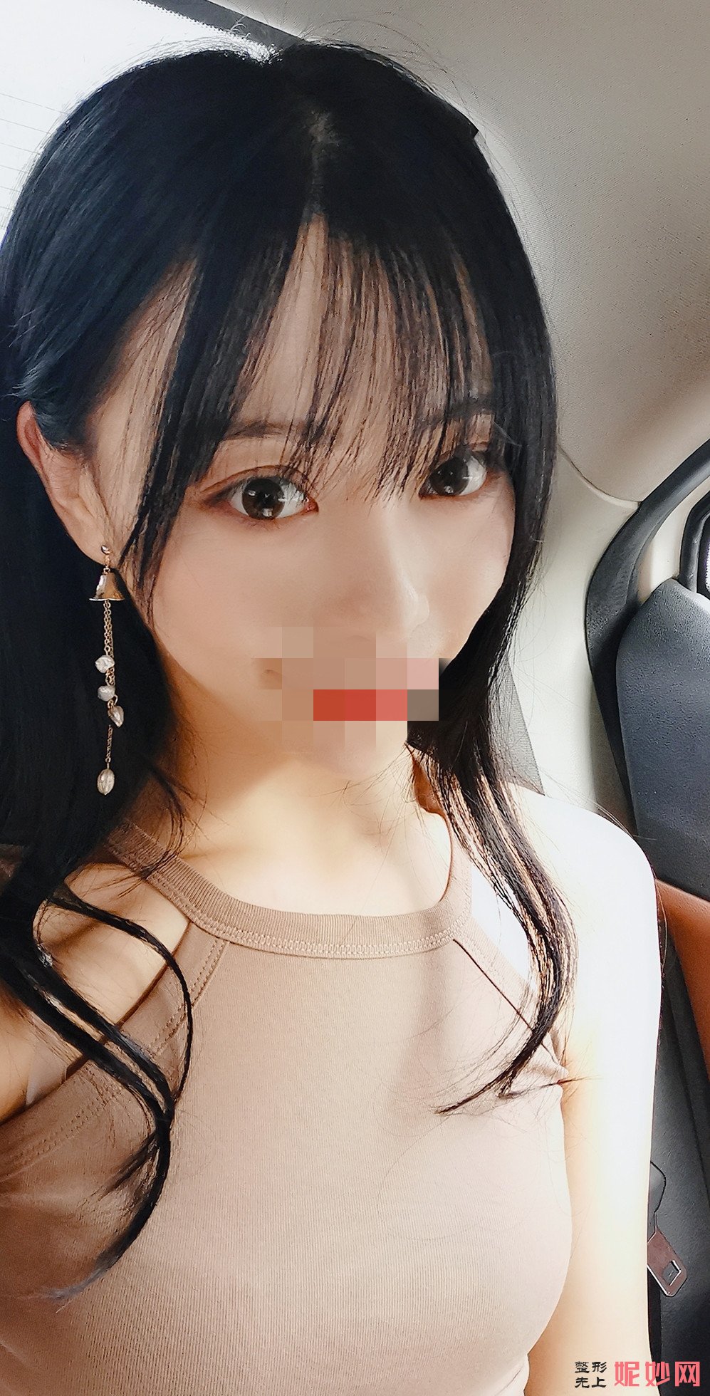成都市西区医院整形美容科宋华敬面部填充怎么样？让我的大脸变小脸了！