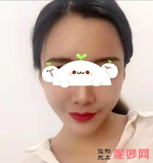 成都鹏爱悦己医疗美容门诊部赵普阳瘦脸*打的好吗？不知不觉脸真的在变小！