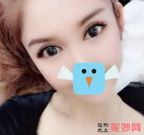 成都鹏爱悦己医疗美容门诊部赵普阳瘦脸*打的好吗？不知不觉脸真的在变小！