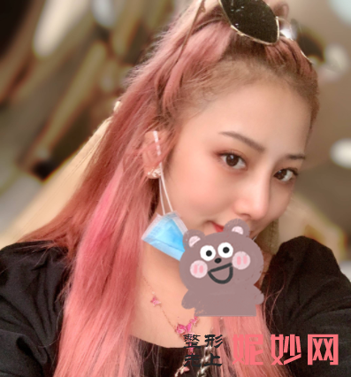 黄富伟做鼻子怎么样？