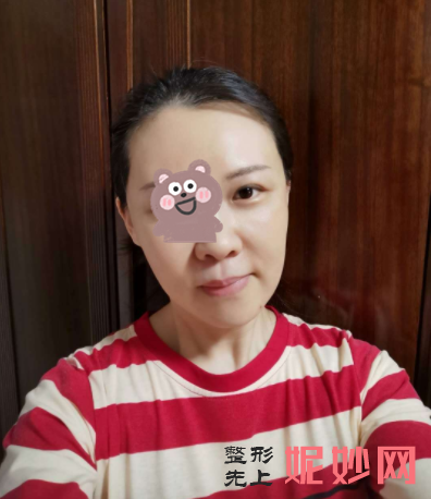 宋华敬面填怎么样？