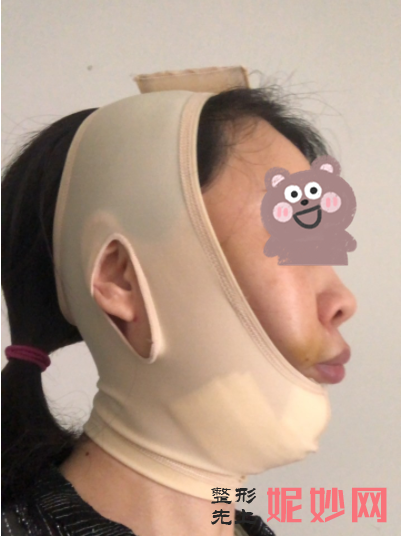 宋华敬面填怎么样？