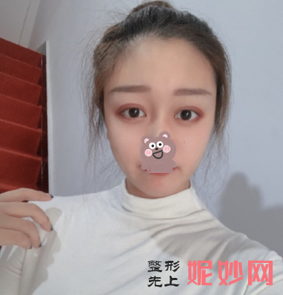张笑天磨骨一般多少钱？