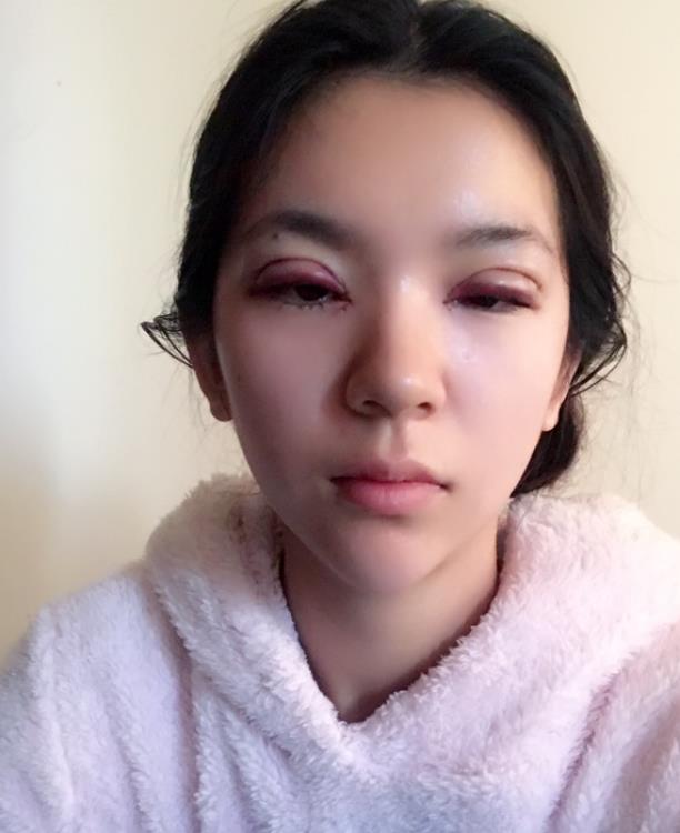 割双眼皮需要多少钱一次？一般价位是多少