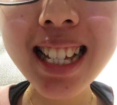 雅度口腔医院是正规医院吗？