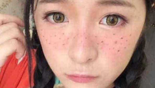 激光美容祛斑一次多少钱