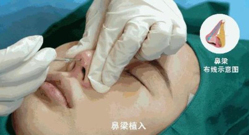武警广东总队医院整形美容中心价格表