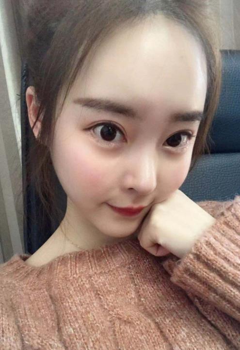 温州加美整形美容医院假体隆鼻和鼻头缩小技术如何？