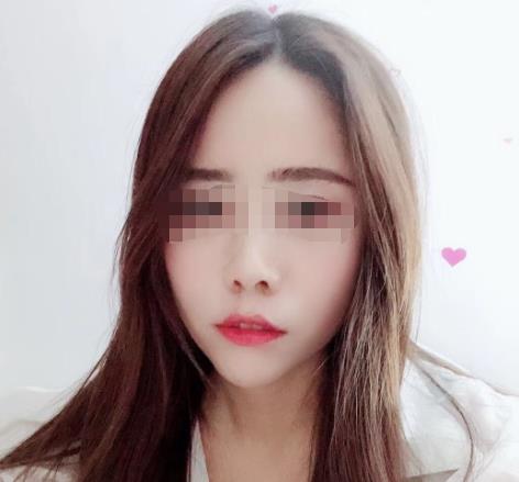 青岛山大皮肤科专家哪个好？医生简介+案例详情