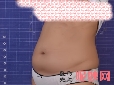 天津华中医疗整形医院是正规的么？内附有医生介绍~吸脂案例分享+价格表