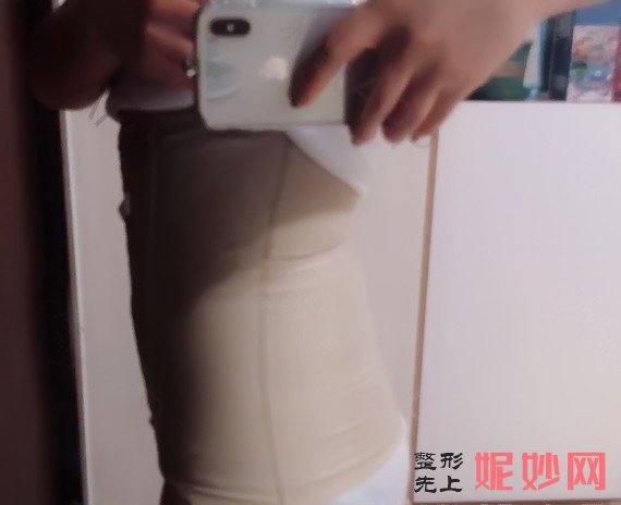 天津华中医疗整形医院是正规的么？内附有医生介绍~吸脂案例分享+价格表
