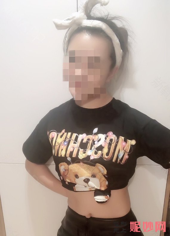 天津华中医疗整形医院是正规的么？内附有医生介绍~吸脂案例分享+价格表