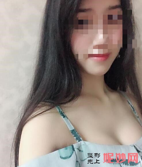 深圳北大李天石做胸怎么样？让我有了性感的身材！