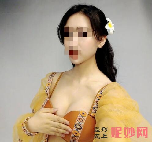 深圳北大李天石做胸怎么样？让我有了性感的身材！