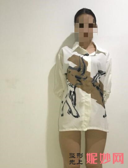 深圳北大何君君做狐臭手术怎么样？让我夏天穿裙子没有尴尬了！