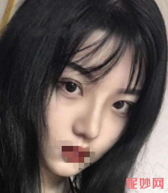 深圳北大何君君鼻综合怎么样？让我鼻子也让别人羡慕了！