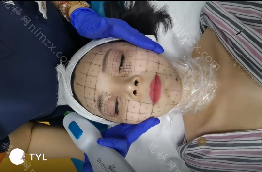 北京小忠丽格医院怎么样？医院简介_医生团队及热玛吉案例分享