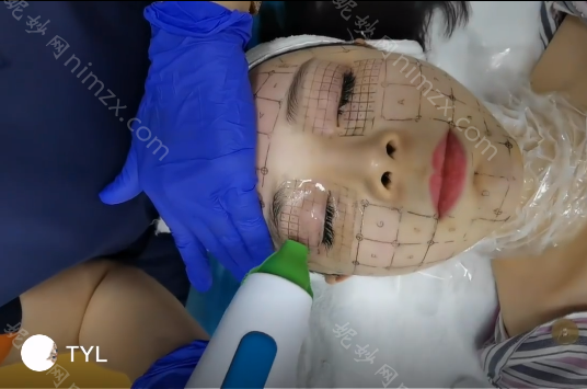 北京小忠丽格医院怎么样？医院简介_医生团队及热玛吉案例分享