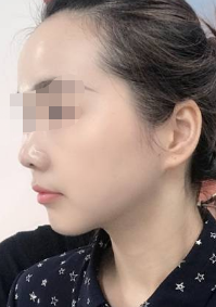 上海华美和九院哪个技术好,口碑怎么样,都是正规的吗？附九院信息和案例介绍