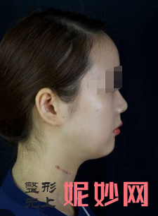 上海华美和九院哪个技术好,口碑怎么样,都是正规的吗？附九院信息和案例介绍