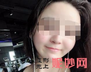 北京八大处颧骨内推怎么样？附八大处磨骨案例一览和价格表！